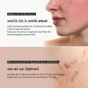 10 최고의 판매 수자원 기반 - water8