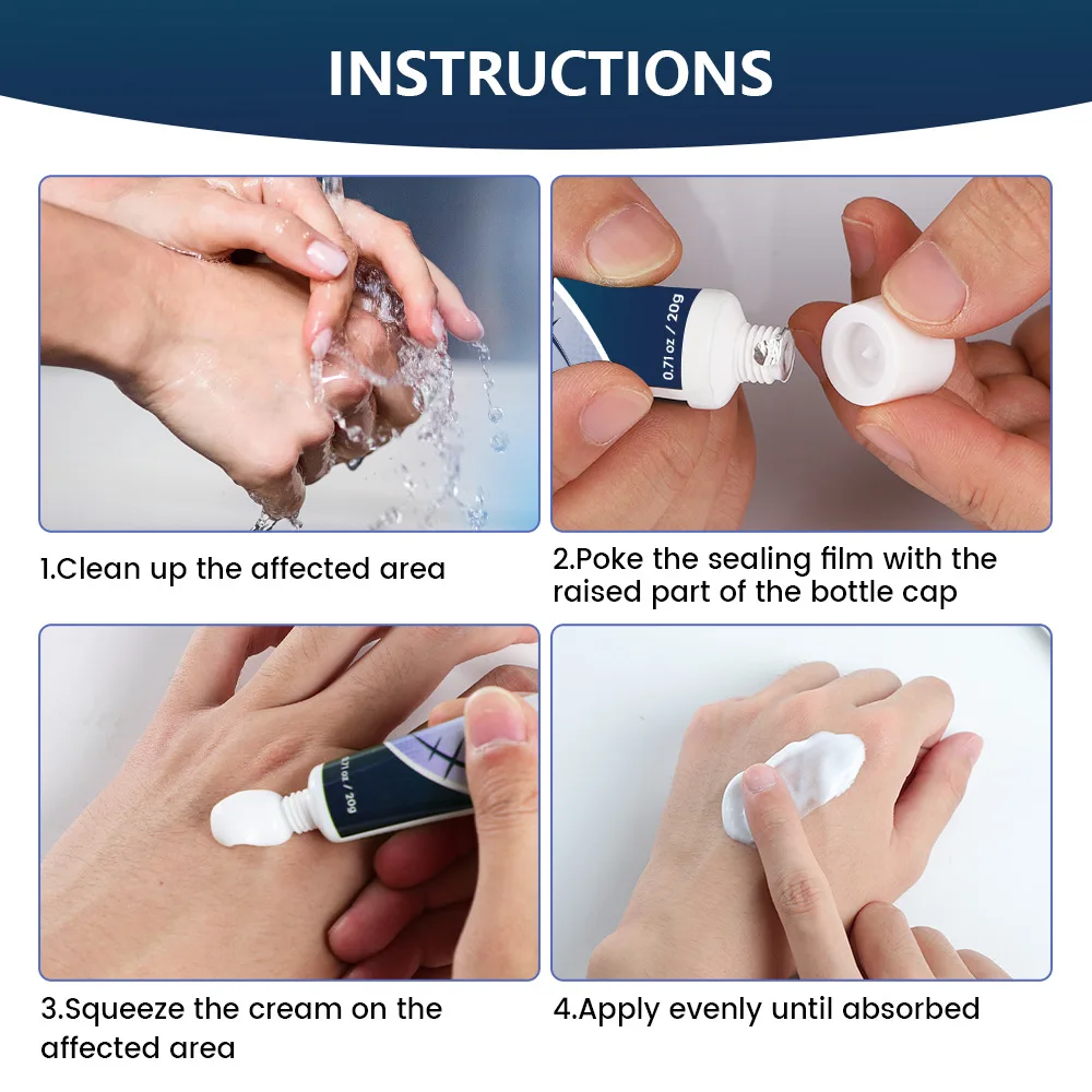 جل الندبة الطبيعية زيت اللافندر يتلاشى الندبات القديمة كيلويد إصلاح العلاج علامات التمدد تخفيض بعد العملية حب الشباب بقعة مزيل #4