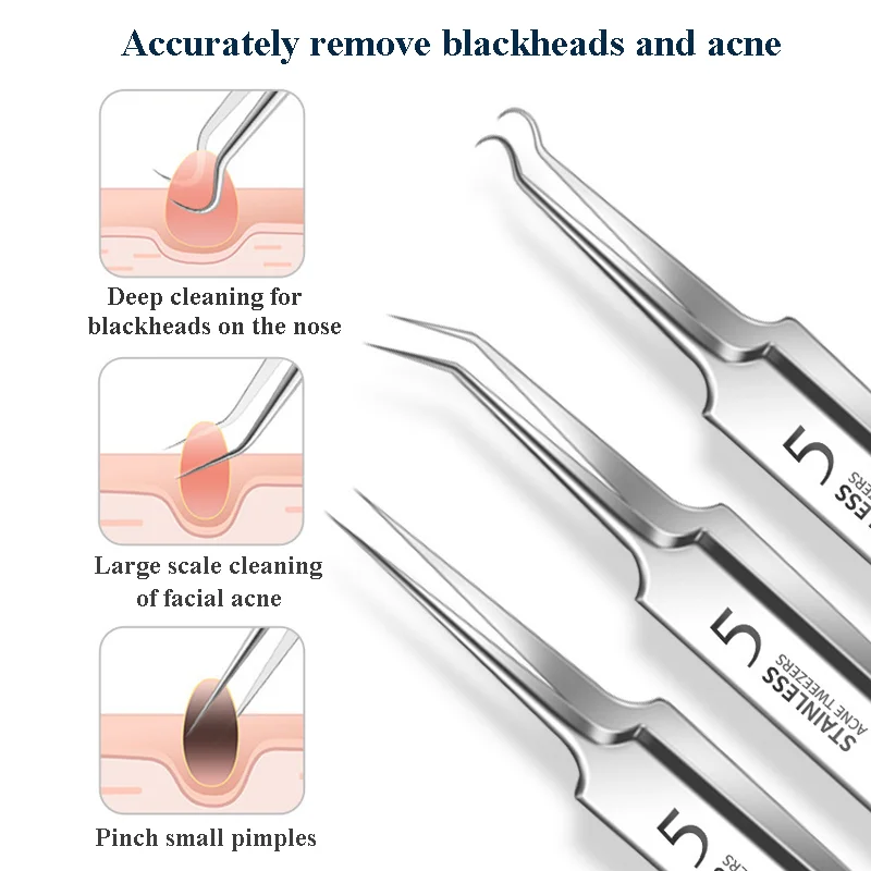 Pinzas para el cabello encarnado, agujas para eliminar espinillas y acné, limpiador de puntos negros, limpieza profunda de poros, herramientas para el cuidado de la piel facial, 4-11 Uds.