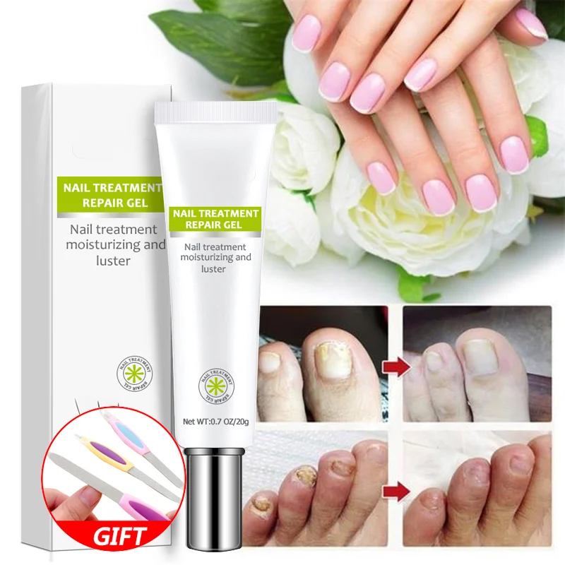 

1/2pcs Nail Repair Nourishing Brighten Foot Finger Care Nail Serum Nail Cream Women Men Nails Products