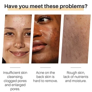 10 MAIN SALES SKIN SOBONETE SOBONETE - №6