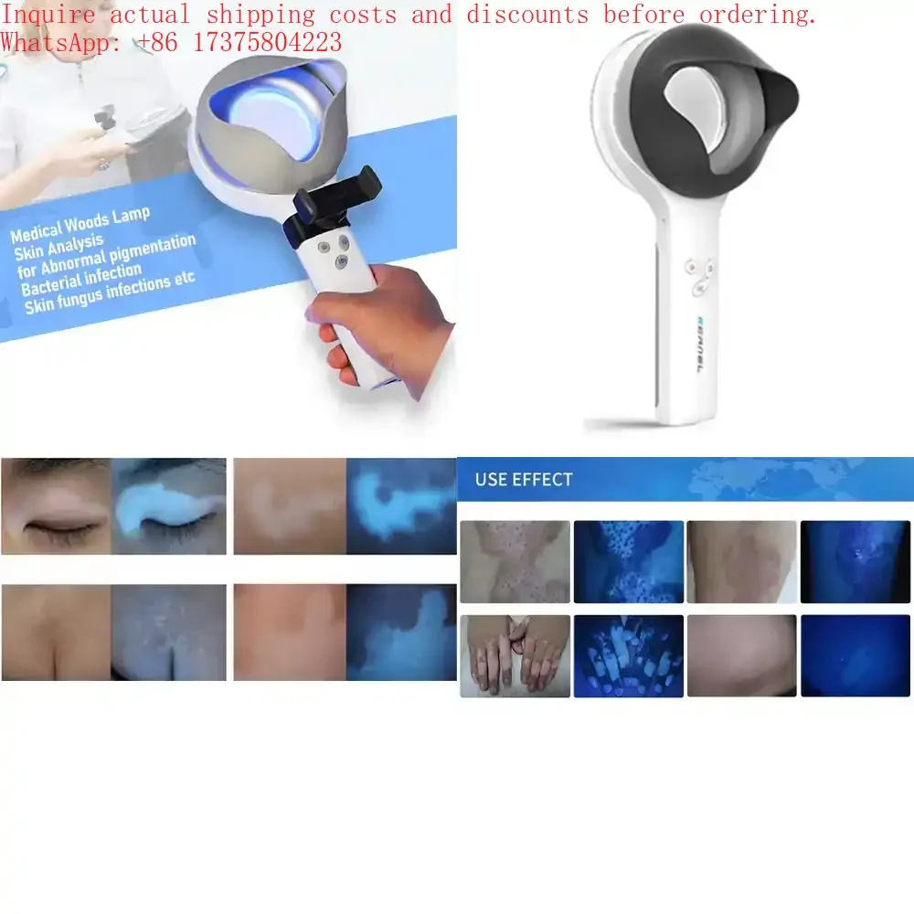 

Kernel KN9000B Portable Handheld Woods Lamp Dermatoscope for Dermatology Use
