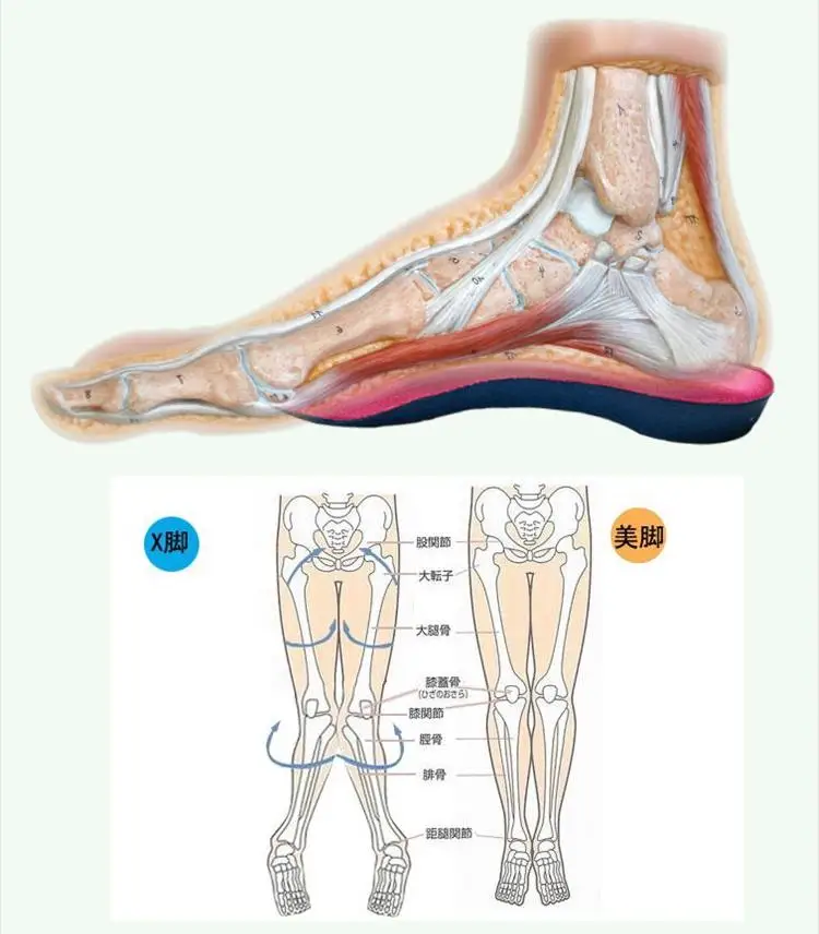 MagiDeal3/4 Orthotic Insoles Arch Support Fallen Arches Over Pronation