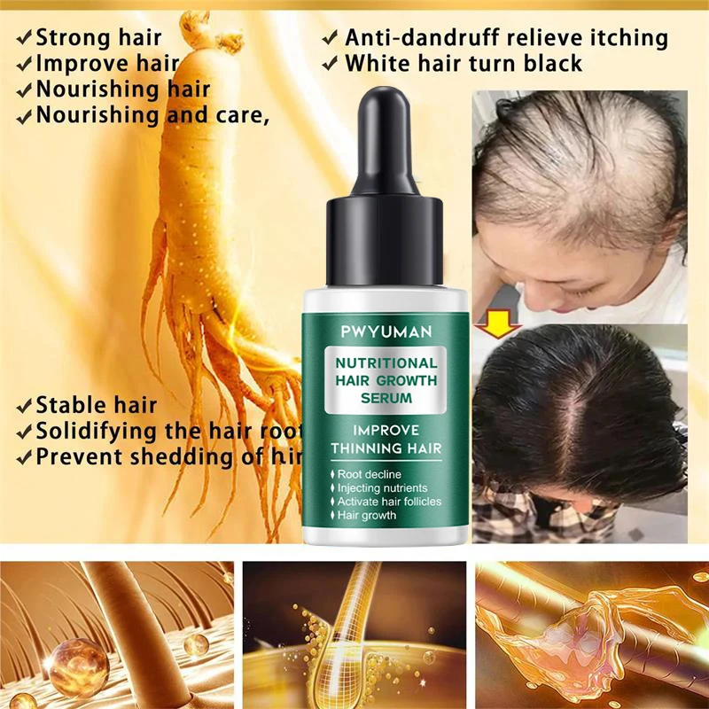 Ginger Hair Growth Products For Man Women Hair Loss Treatment Fast Regrowth Thicken Repair Nourishing Biotin Liquid Hair Care