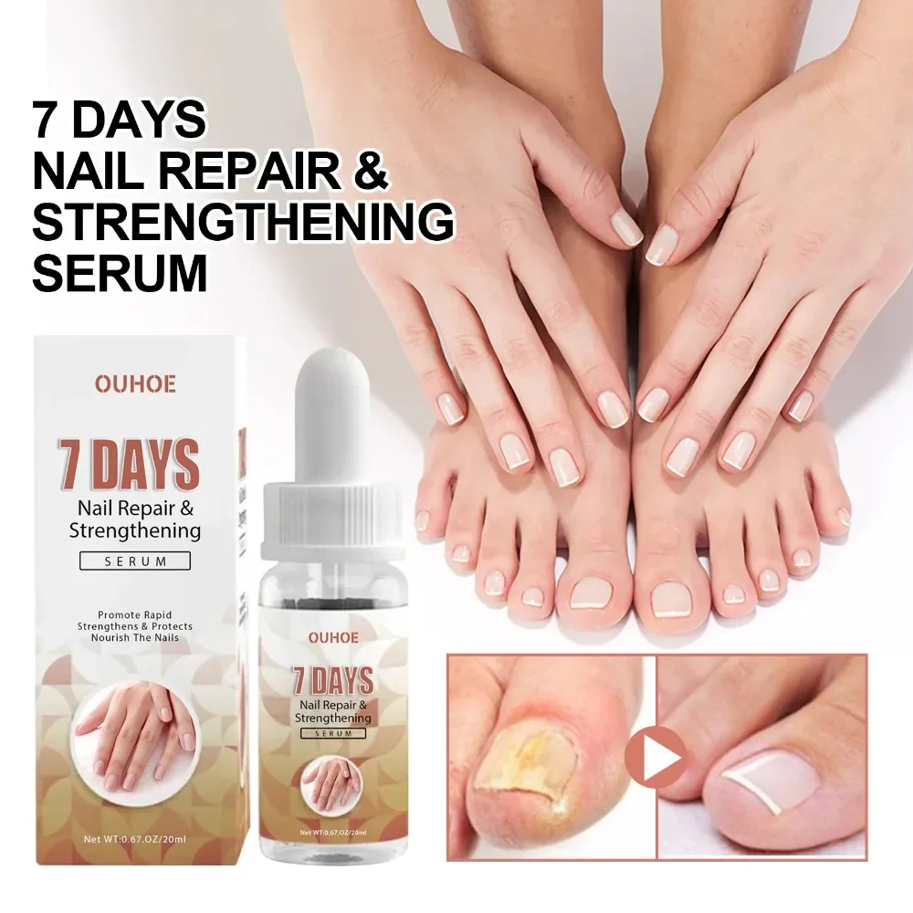 uñas productos 1pc Repairing Serum Fine Good Durable Nails Repairing Serum Nourishing Nails Essence Nail Treatment Liquid كعب