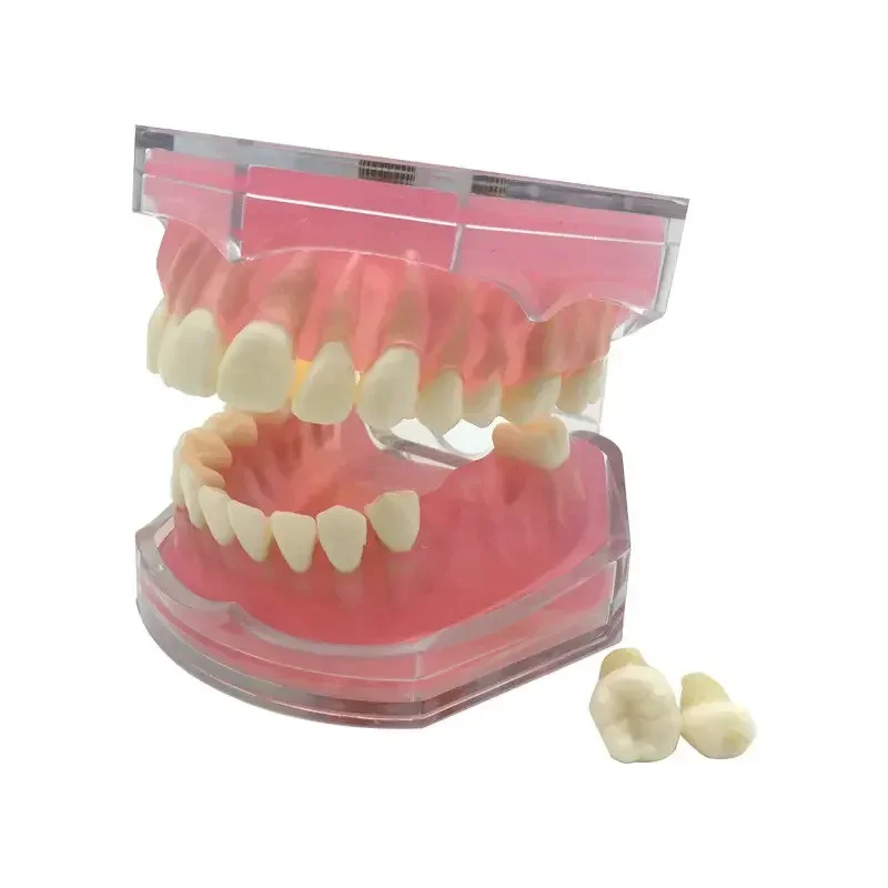 

Dental Study Teach Dental Standard Model with Removable Teeth Teeth Model