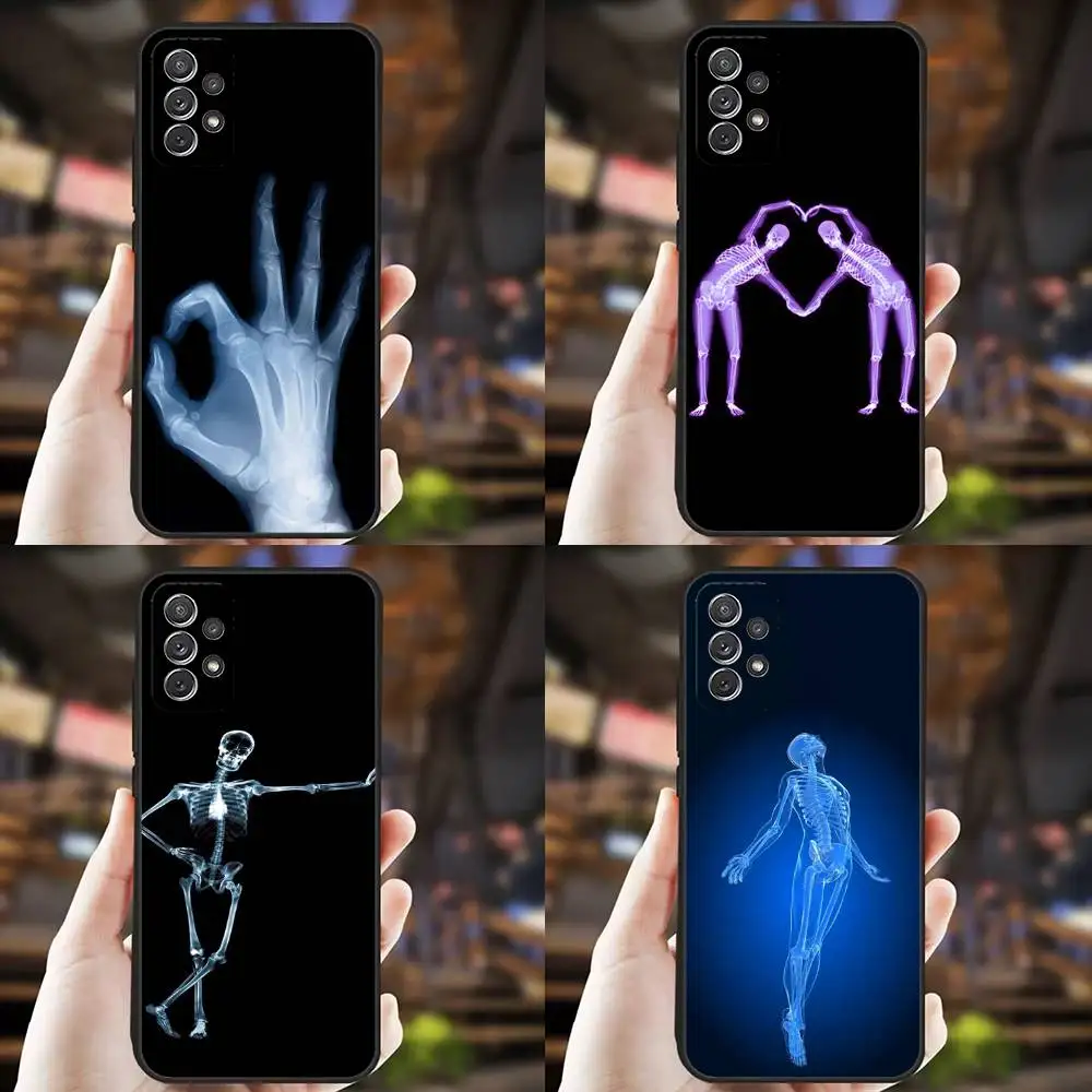 

X-RAY Radiological Skeleton Phone Case For Samsung S25,S24,S21,S22,S23,S30,Ultra,S20,Plus,Fe,Lite,Note,10,9,5G Black Cover