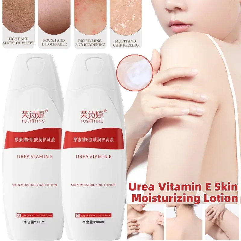 20% Urea Vitamin E Body Lotion Absorbs Effectively Improve Rough Chicken Skin Hydrating and Moisturizing 200ml