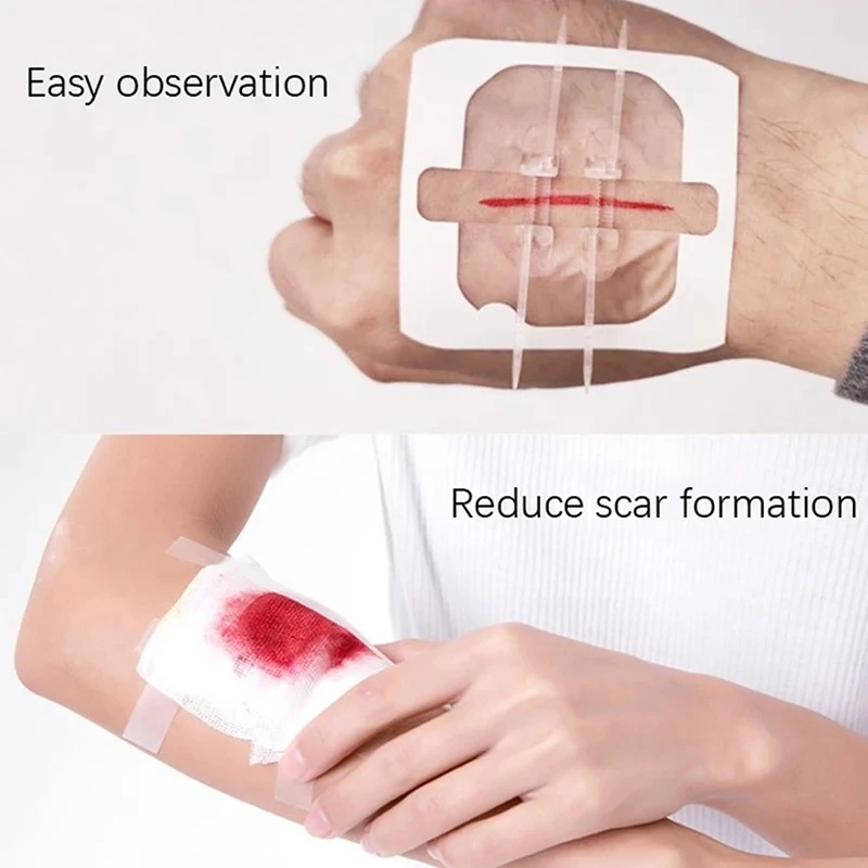 

2-10 wound dressings, wound closer, no need for suturing, fast and painless, portable for outdoor home medical care