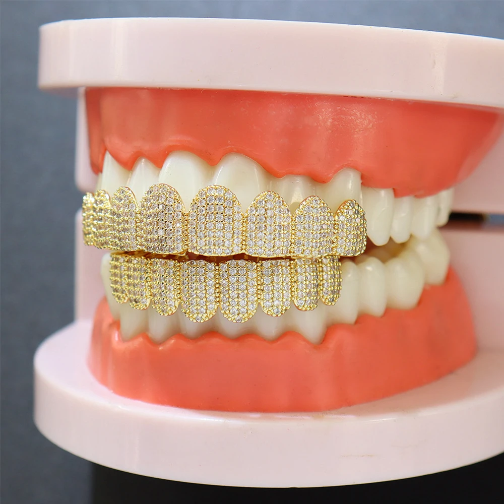 Vollständig mit Gold besetzte – Teeth Whitening Moulds Bewertung und Preis