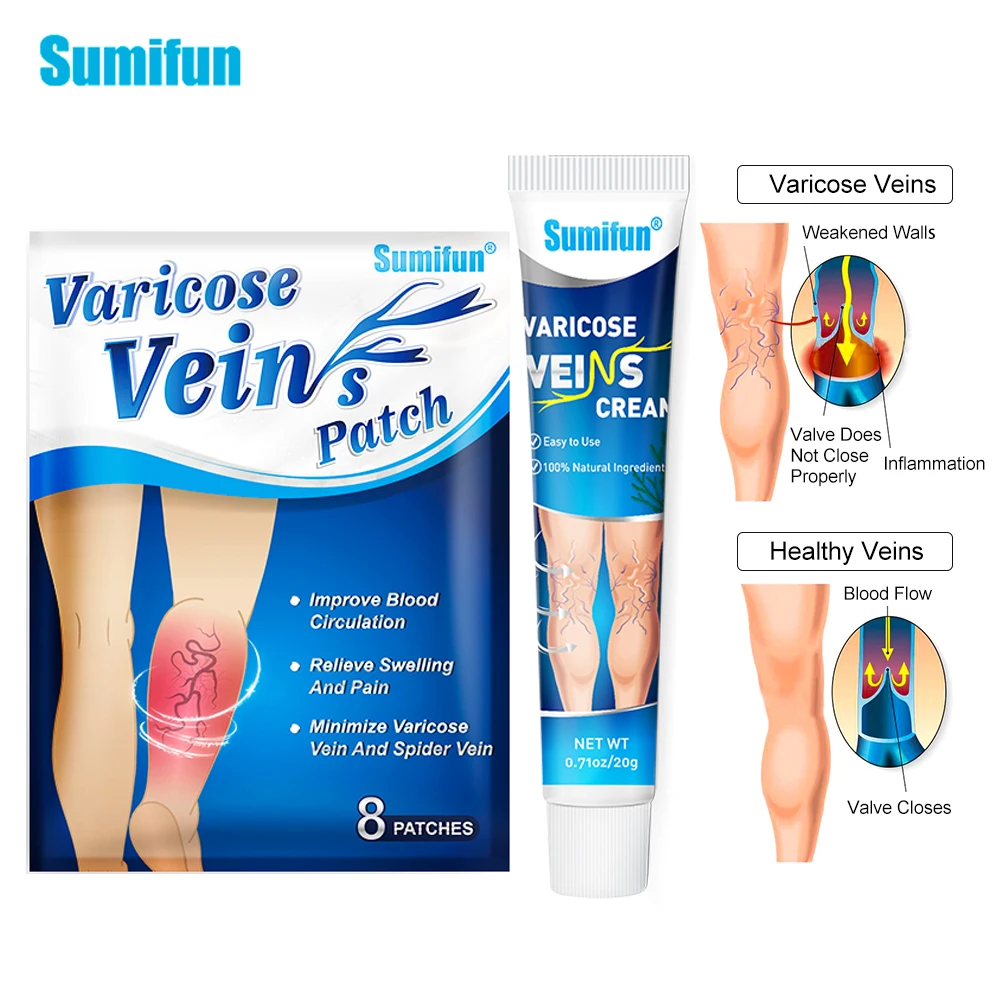 Sumifun Varicose Vein Cream Varicosity Angiitis Spider Removal Legs Dilated Treatments Patch Phlebitis Pain Relief Health Care