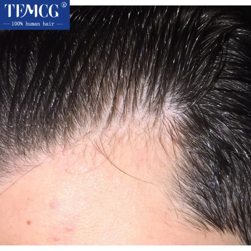Male Hair Prosthesis Skin 0.02mm Base 90Density Men's Wig Human Hair Undetectable Replacement Systems Men's Capillary Prothesis
