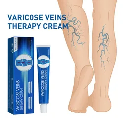 Varicose Vein Repair Cream Tongmai Effective Relieves Leg Bulge Pain Treatment Vasculitis Phlebitis Vein Massage Cream