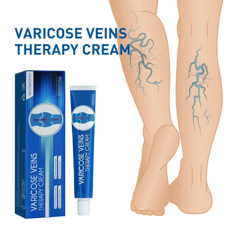 Varicose Vein Repair Cream Tongmai Effective Relieves Leg Bulge Pain Treatment Vasculitis Phlebitis Vein Massage Cream