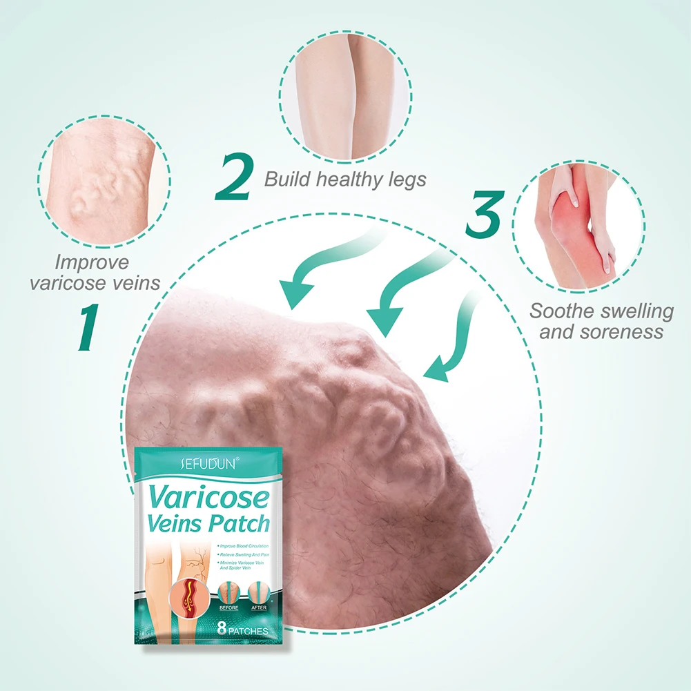 Natürliche Inhaltsstoffe Krampfadern-Aufkleber, 8 Stück, sicheres, gesundes Reparaturpflaster für Krampfadern, schnell wirksam für die Körperpflege