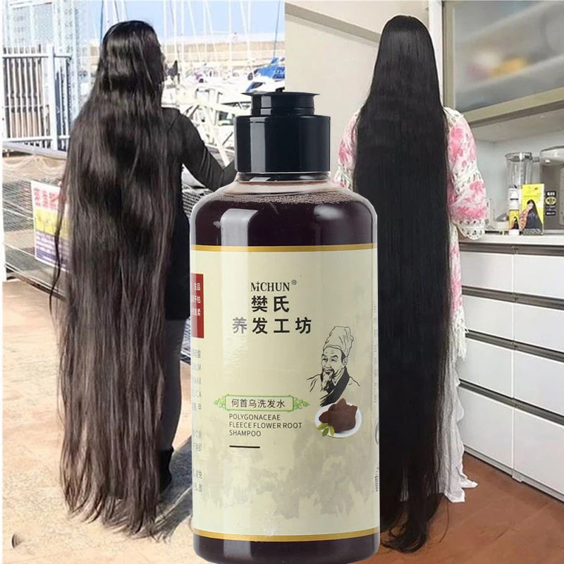 300ml Africa Women Traction Alopecia Treatment Hair Growth Product for Men Shampoo Hair Loss Treatment Get Rid of Wigs 2pcs/lot