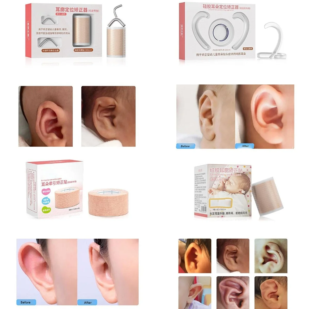 1Roll Tape Baby EarCorrector Cuttable Breathable Infant Toddler Auricle Valgus Silicone Correction Patch With Ear Support Patche