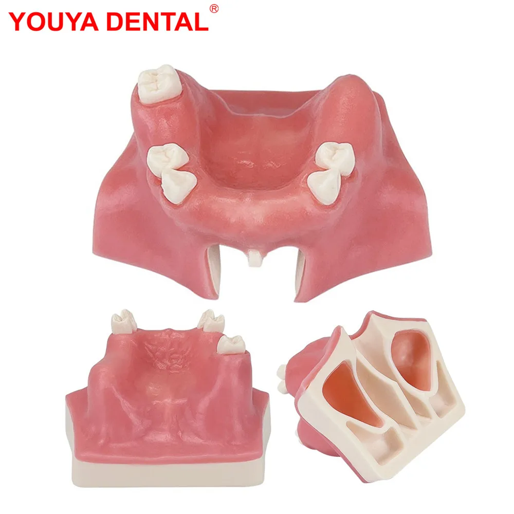 1pcs Dental Teeth Model Maxillary Sinus Model Implant Practice Model For Teaching Demo Dentistry Students Studying Training Exam