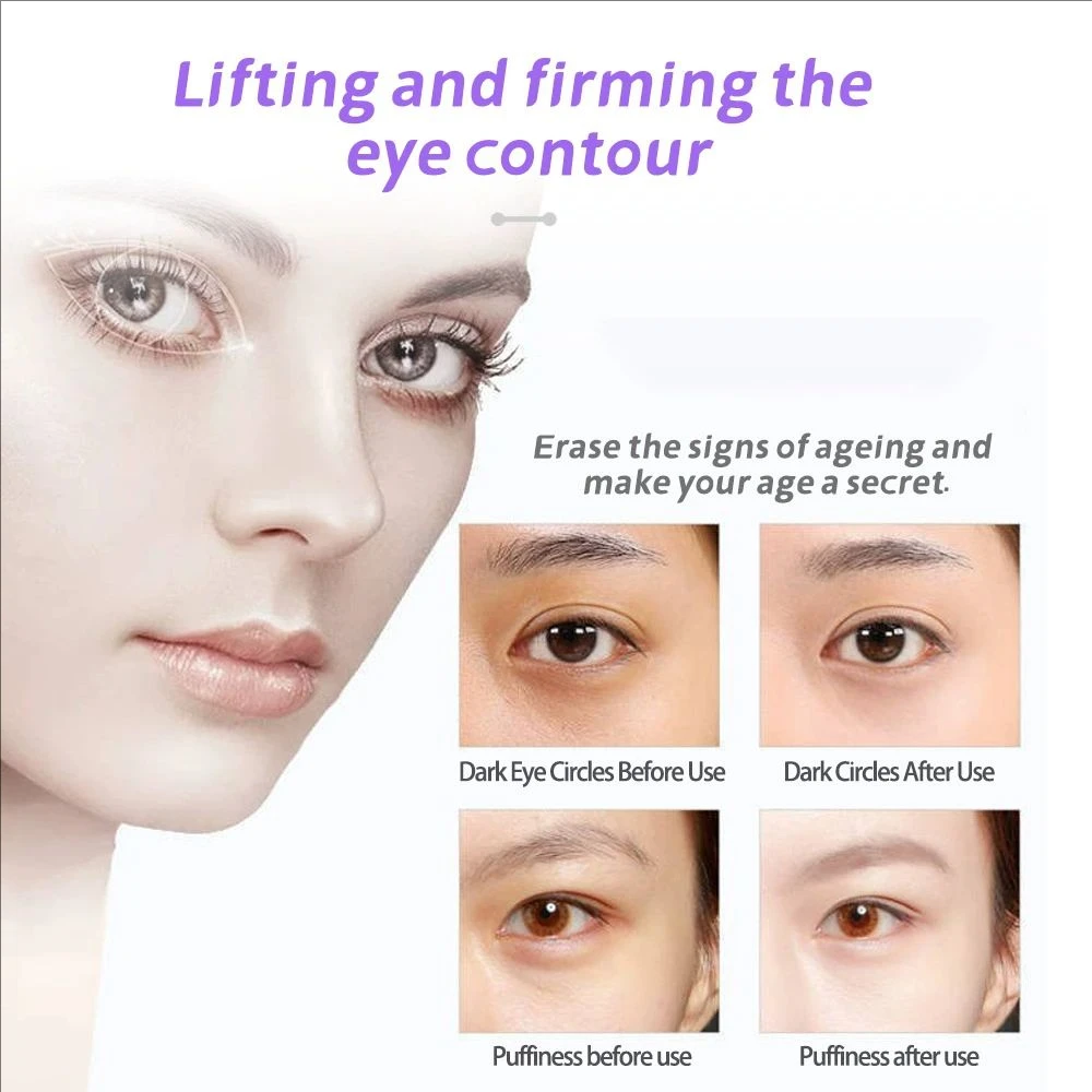 Multifunctionele Oog Massager Trillingen LED Foton Therapie EMS Verjonging Huid Gezicht Machine Lifting Anti-rimpel Schoonheid Apparaat