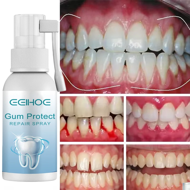 Damaged Gum Repair Care Spray Relieve Sore Gums Allergy Deep Cleaning Teeth Stains Tartar Serum Dental Caries Toothpaste