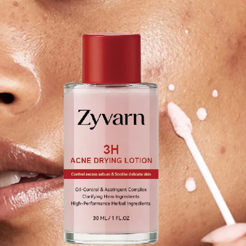 30ml-pink-salicylic-acid-concentrated-acne-essence-containing-salicylic-acid-lactose-acid-calamine-double-acid-dual-care