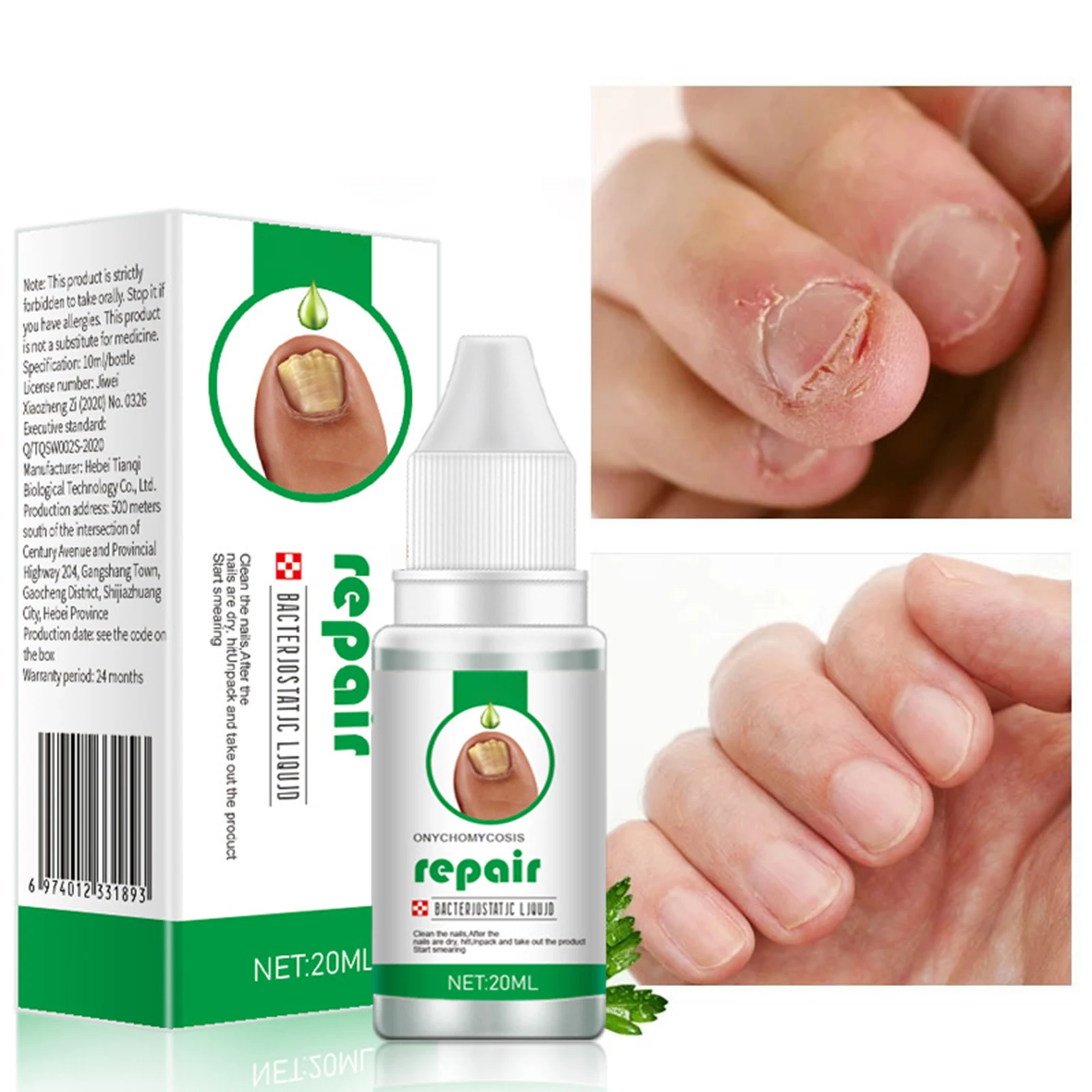 20ml nails repair Essence liquid Renew Damaged, Broken, Cracked & Discolored Nails for Damaged Discolored Yellow Nails