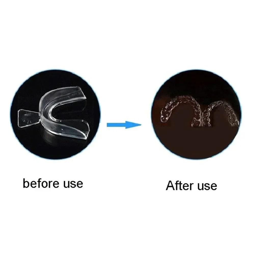 2/4 واقي الفم EVA واقي الأسنان واقي الفم مناسب لطحن الأسنان أثناء الليل ومضاد للشخير وتبييض الملاكمة #4