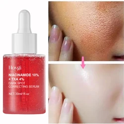 Niacinamida Hidratante Clareamento Soro, Correção de Mancha Escura, Fade Fine Lines, Limpeza Profunda, Removedor De Maquiagem, Cuidados Com A Pele Coreano