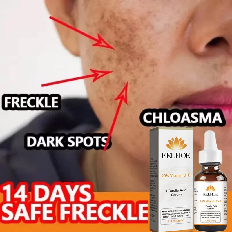 

Vitamin C Whitening Serum Remove Dark Spots Whiten Fade Freckles Fine Line Lift Firm Anti-aging Brighten Beauty Korean Skin Care