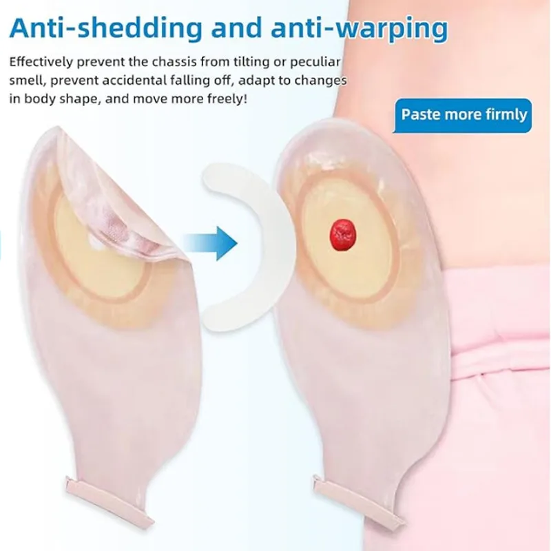Ostomy Barrier Strip Elastic Ostomy Barrier Tape Waterproof Hydrocolloid Extender Pressure Sensitive Sticker for Colon Bag