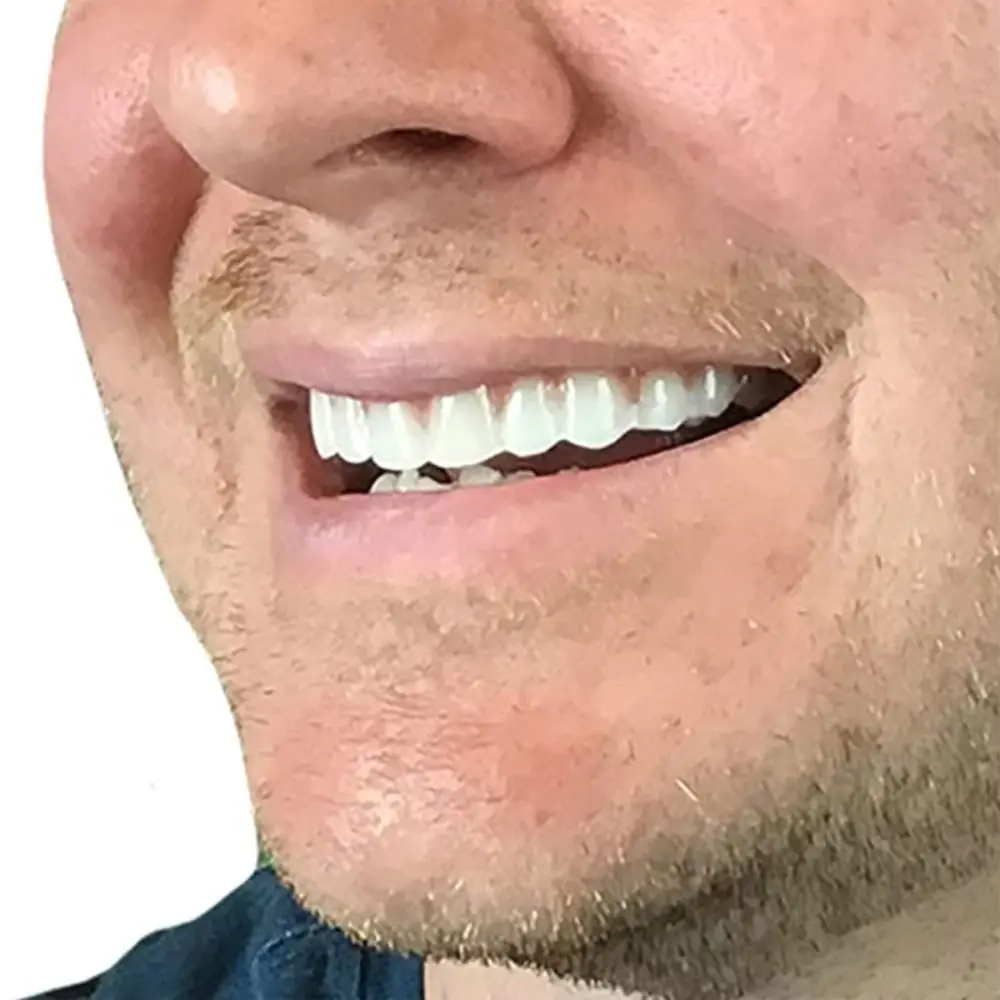 DIY Silicone False Teeth Confident Smile with Filling Teeth Glue Cosmetic Dental Veneer Whitening Comfortable Fit
