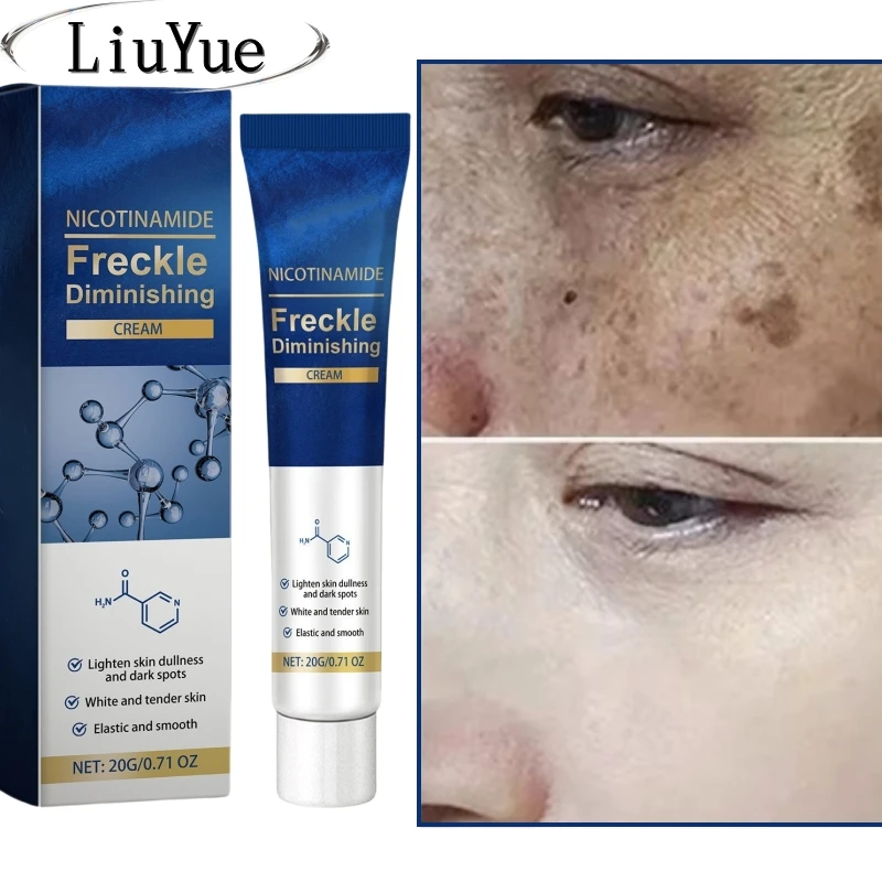 

Nicotinamide Freckle Cream Face Remove Dark Spots Melasma Lighten Melanin Moisturizing Brighten Black Skin Care Cream