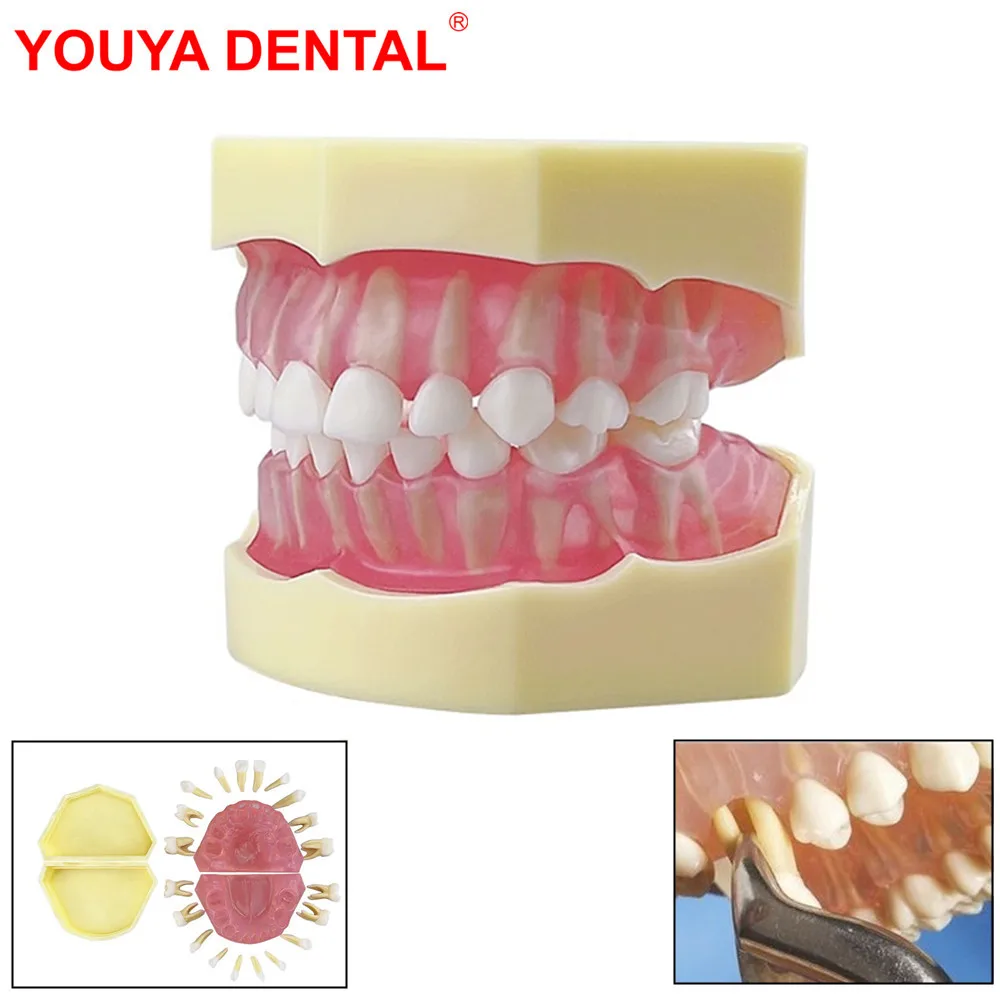 

Kids Teeth Model For Training Practice Tooth Extraction Model Dental Standard Model With Removable Teeth Gums Children TYPODONT