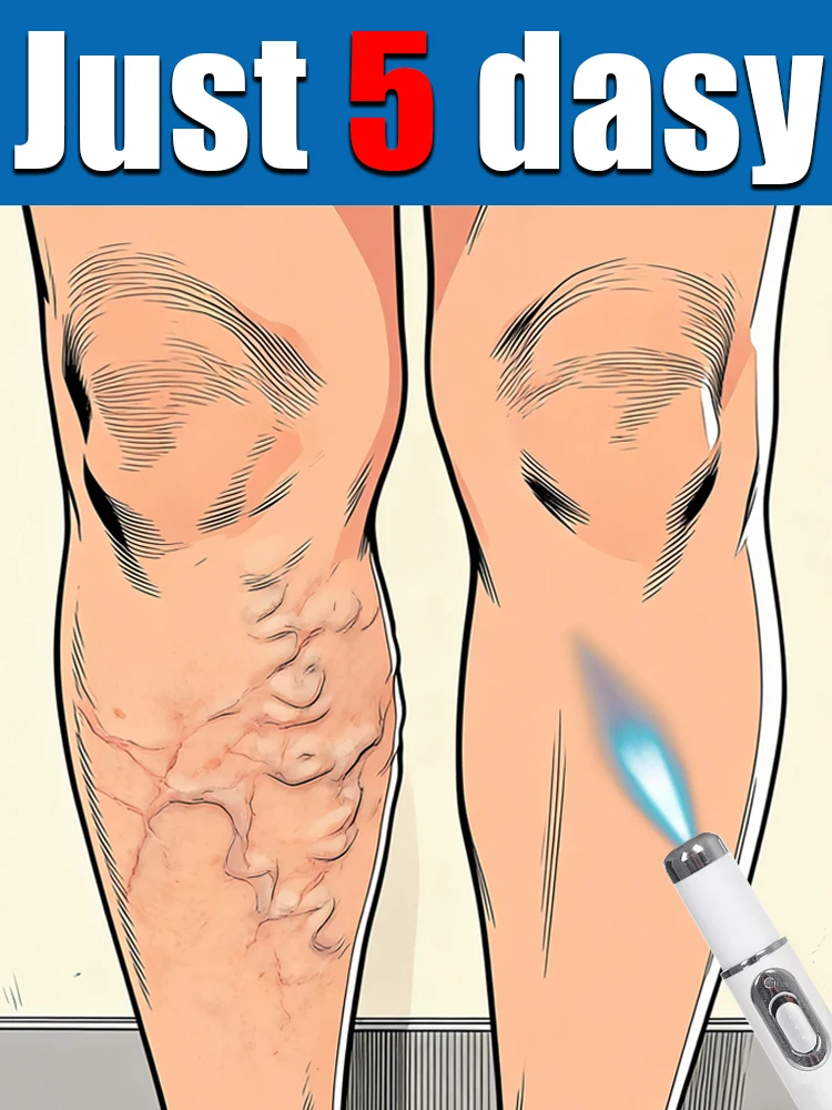 

7 дней, проведенные в условиях стационара, помогают решить проблемы с венами ног. Подходит как мужчинам, так и женщинам.