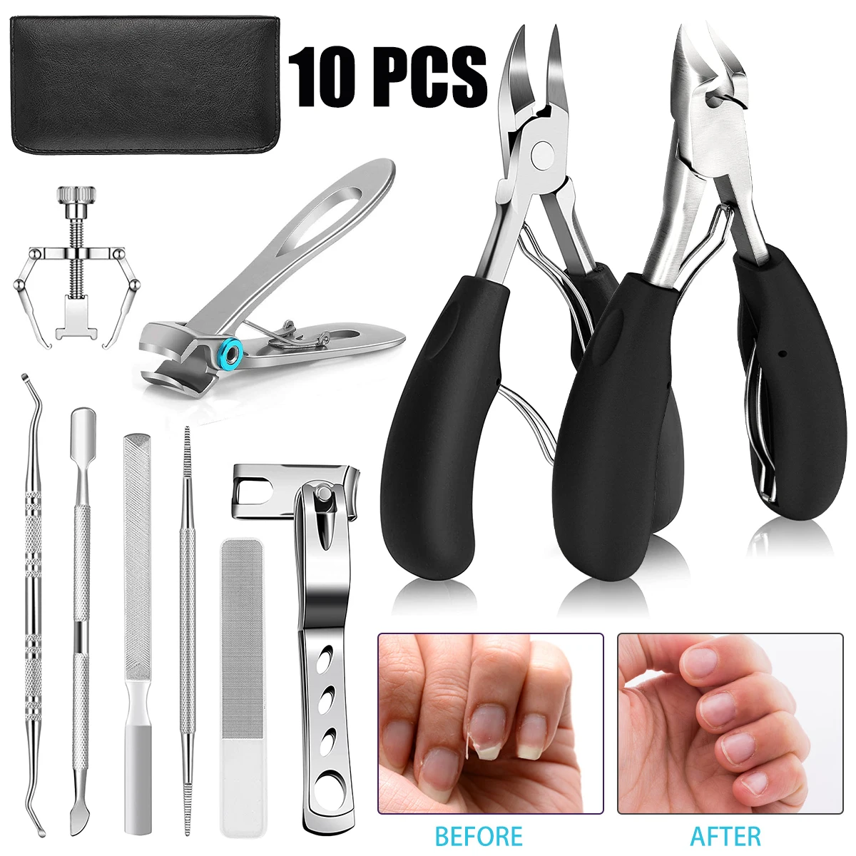 10Pcs Ingrown Toenail Clippers Kit Stainless Steel Ingrown Toenail Removal Kit Toenail Clippers Set for Ingrown and Thick Nail