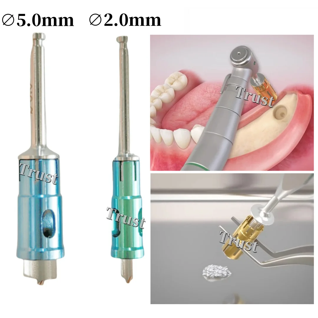 Dental Never Loss Bone Collector Drills Implant Stopper Self Bone Powder Harvest 2.0/5.0mm