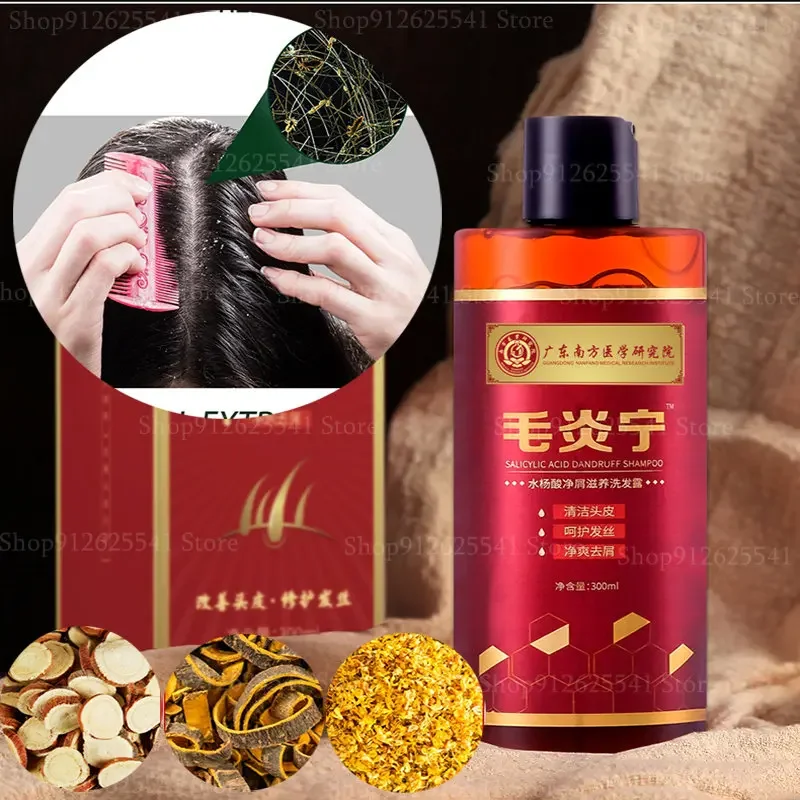 300ML Chinese Herbal Anti-Dandruff Anti-Itch Shampoo Remove Dandruff Control Itching Antipruritic Shampoo Oil-control Refreshing