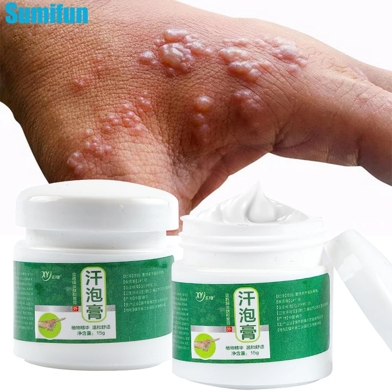 Sweat Blister Anti-itch Cream Relief Sweat Herpes Ointment  Psoriasis Eczema Remove Small Blisters Hand Foot Dry Skin Itchy Care