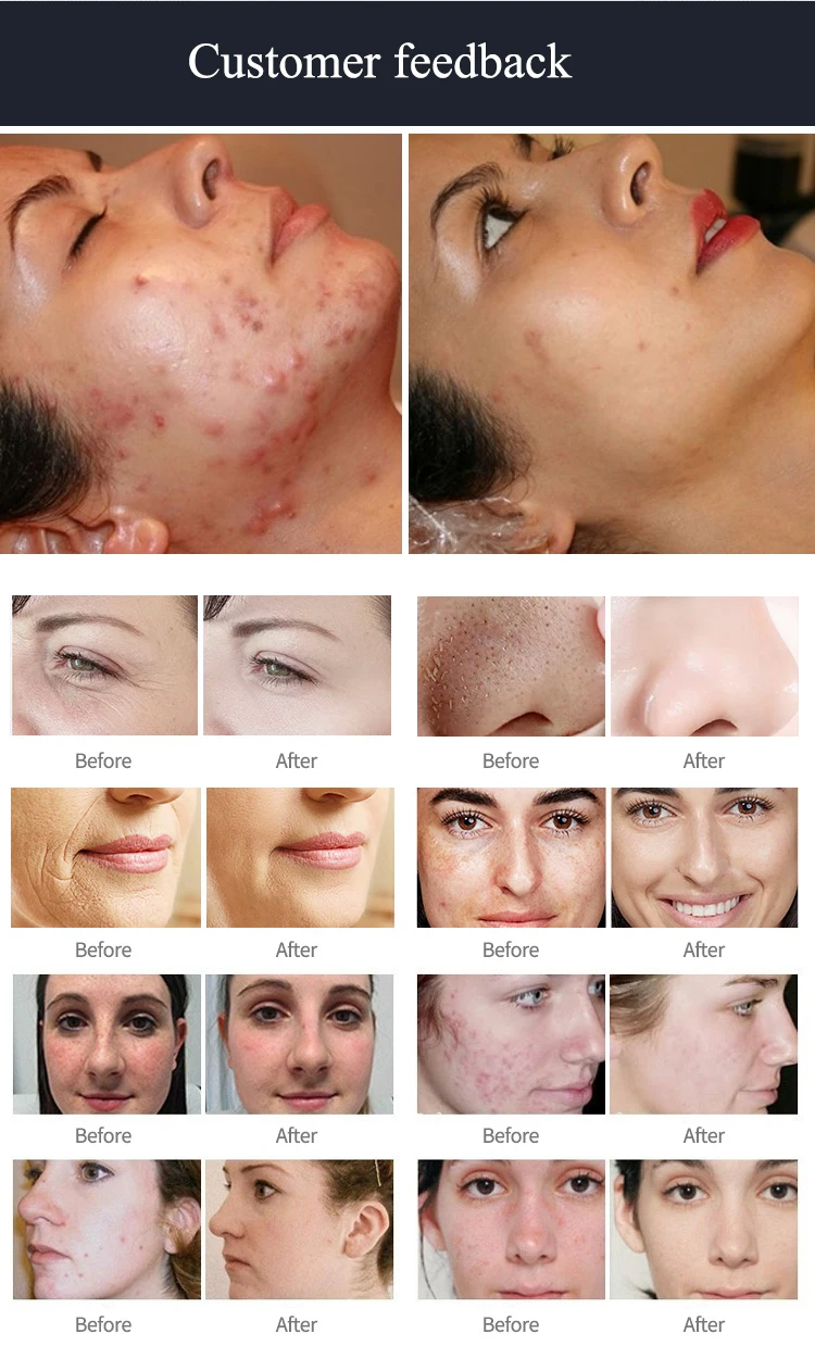 La plus nouvelle Machine d'hydrodermabrasion 7 en 1 avec analyseur de peau, Microdermabrasion faciale, Machine de rajeunissement de la peau, dispositif de Salon