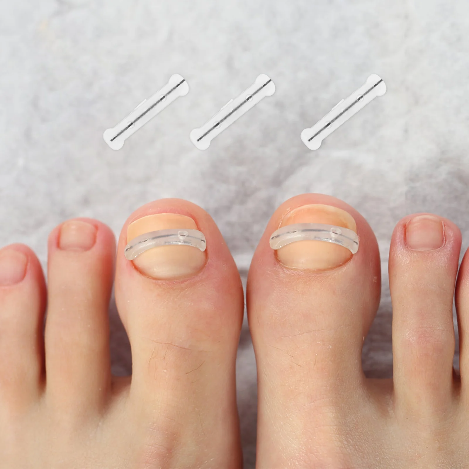 Toenail Correction Brace Stickers Daily Use Tool Line Straightener Silica Gel Professional Wire