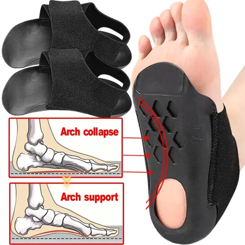 2PCS Arch Support Orthopedic Insole สําหรับเดิน Arch Half Pad X/O ประเภทขา Self-Adhesive สายคล้องสวมใส่รองเท้าส้น