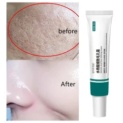 Salicylic Acid Pore Shrinking Cream Repairing Tightening Face Serum Moisturizing Oil Control Skin Care Korean Cosmetic 2024