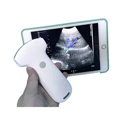 MSLPU94 192 elements Wireless Portable(Handheld) Color Doppler Ultrasound Probe Convex probe