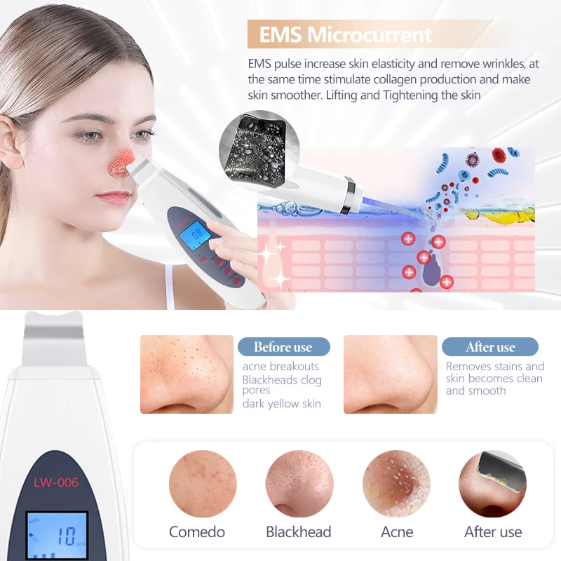 آلة التنظيف العميق للبشرة بالموجات فوق الصوتية لإزالة حب الشباب وتدليك الوجه والكيراتين ورفع الرؤوس السوداء جهاز التجميل #4