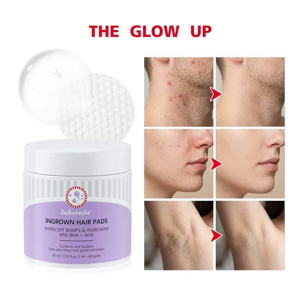 

Пластыри от вросших волос после бритья для мужчин и женщин – помогают предотвратить раздражение и воспаление, отшелушивают кожу подмышек и зоны бикини