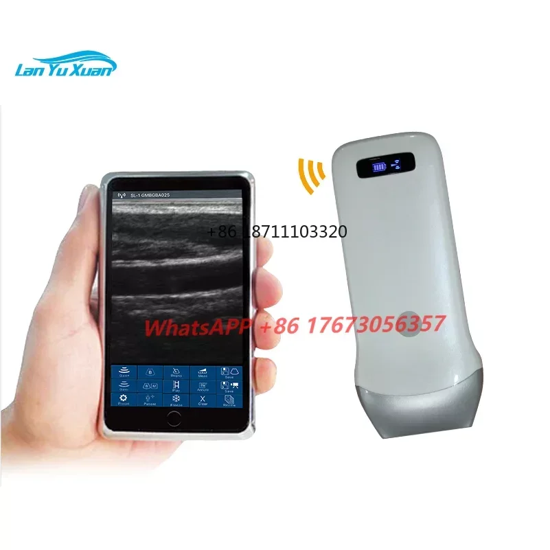 

Mini Portable Wireless Handheld Convex Linear Probe Ultrasound Scanner FMS-011 Medical Devise