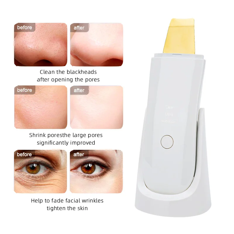 Household 24K-Hz ultrasonic wash machine remove dead skin blackhead spray penetrate the skin restore tender and smooth skin USB