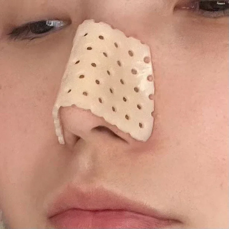 Low Temperature Thermoplastic Board Beauty Fracture Splints High Nose Bridge Reusable Health Care Brace Nasal Shaping Corrector