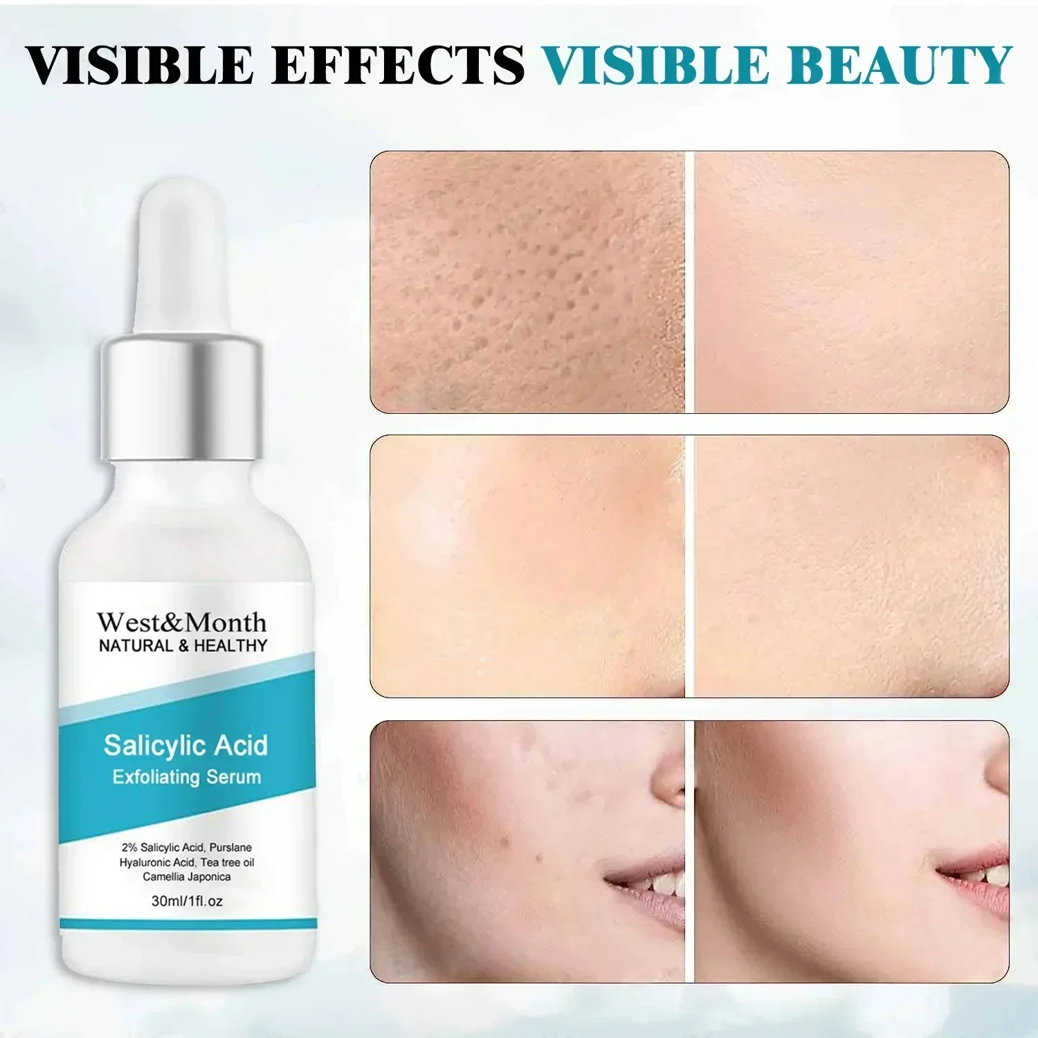 Salicylic Acid Exfoliating Serum Anti Aging Essential Oil รูขุมขนหดตัวลบสิว 30ml Exfoliants Face Peeling GEL Emulsions