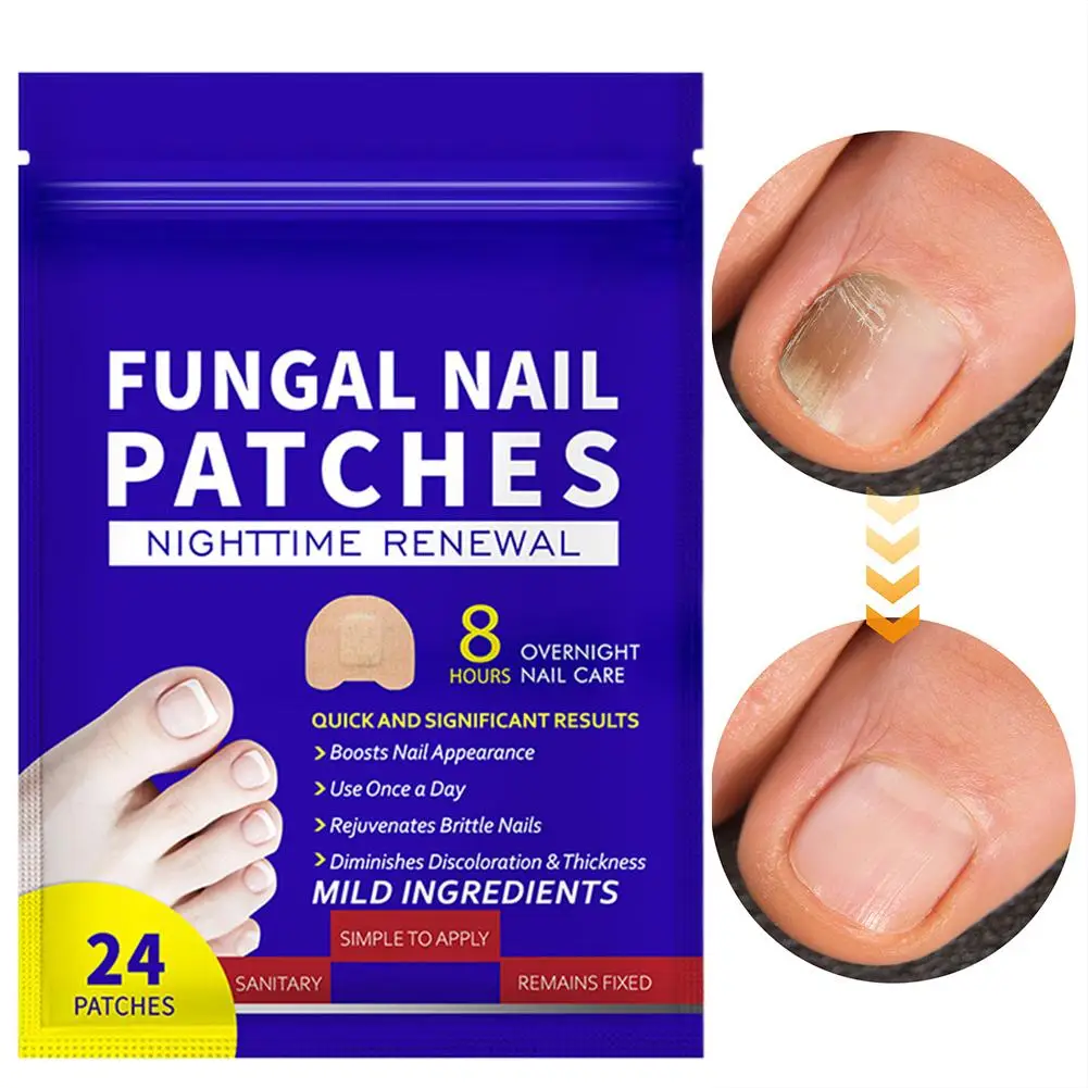 Nail Repair Patches Toenail Renewal Correction Sticker Paronychia Recovery Pedicure Tools Split Nails Protection Tape